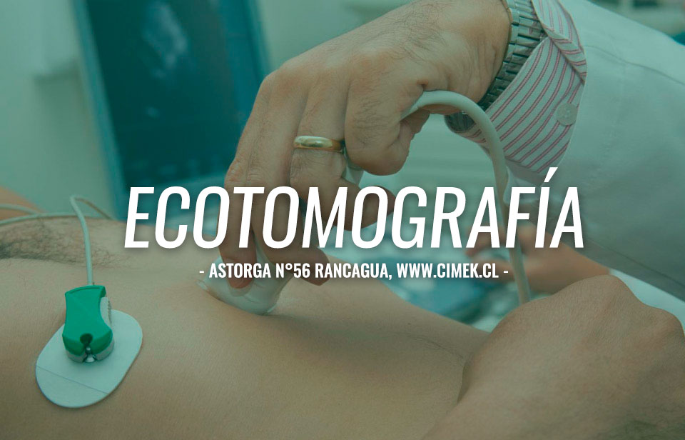 electrocardiograma rancagua