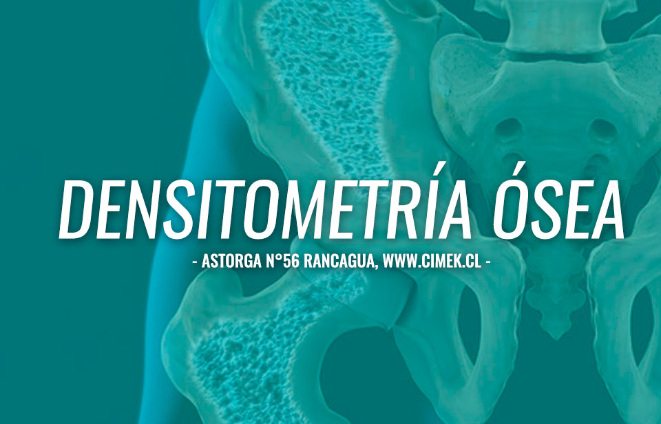 densitometria osea rancagua